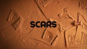 SCARS